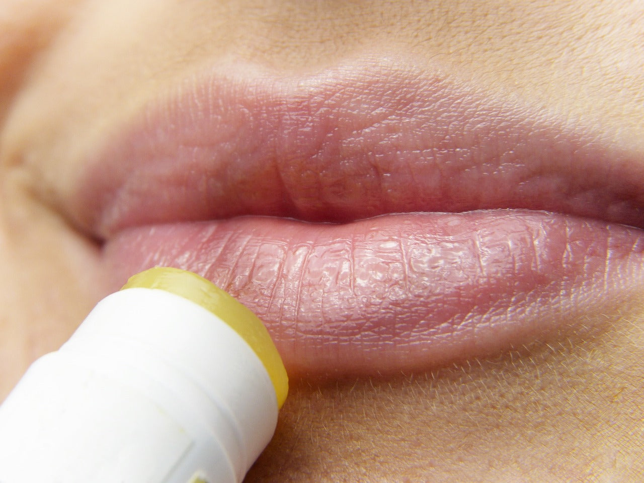 How to Heal Chapped and Cracked Lips?